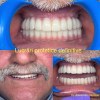 Clinica Dentară Dr. Alexandru Năstase - Implant Dentar Mioveni - Dinti Ficsi Mioveni