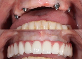 MIRISHINE DENTAL