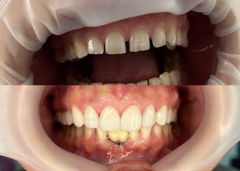 Dr. Laura Rusu Clinică Stomatologică Baia Mare